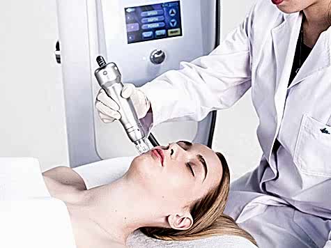 Altın İğne RF Uygulaması