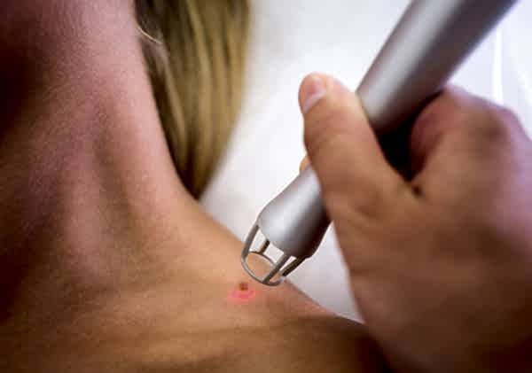 Lazerle Ben Aldırma