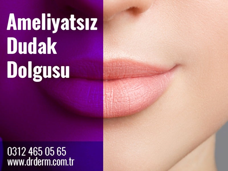 Ameliyatsız Dudak Dolgusu