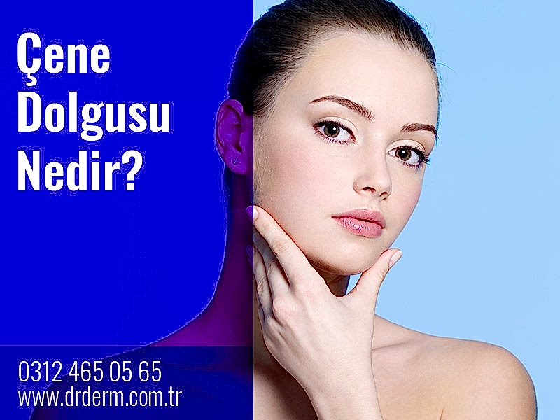 Çene Dolgusu Nedir?