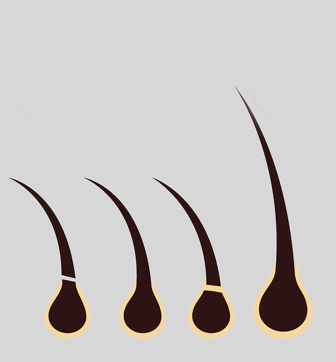 Erkek Lazer Epilasyon Fiyatları