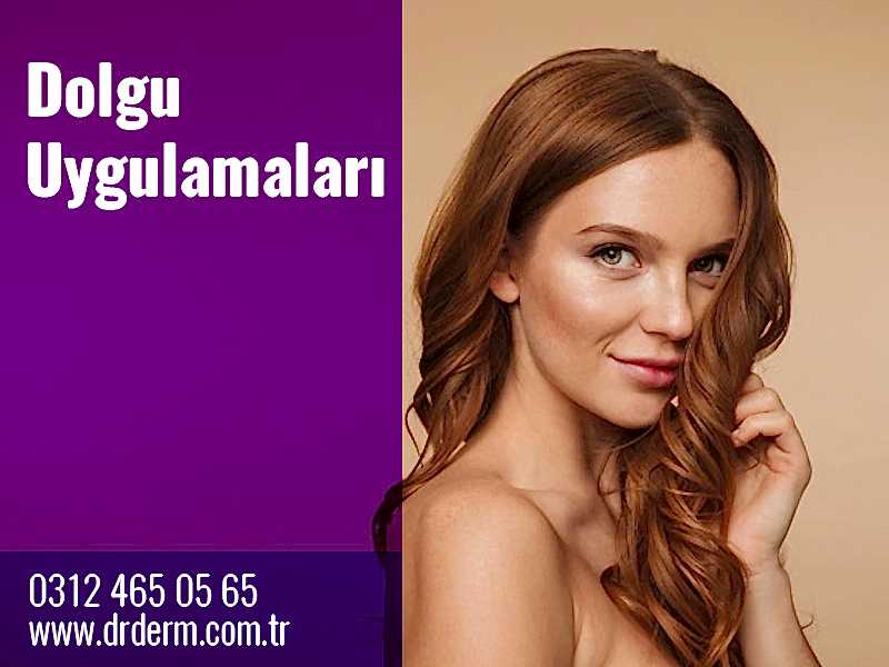Dolgu Uygulamaları