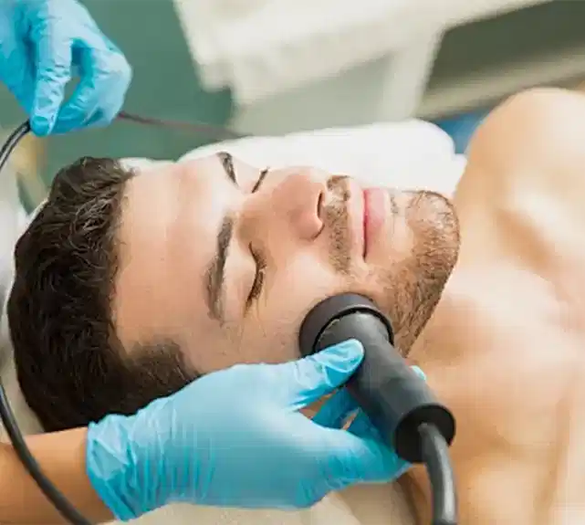 Ankara Lazer Epilasyon Erkek