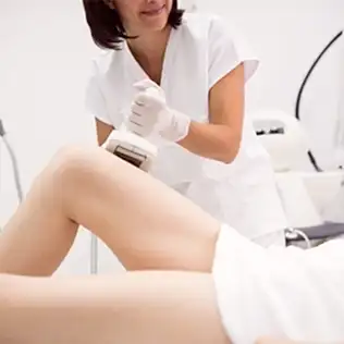 Lazer Epilasyon