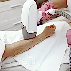 Ankara Lazer Epilasyon